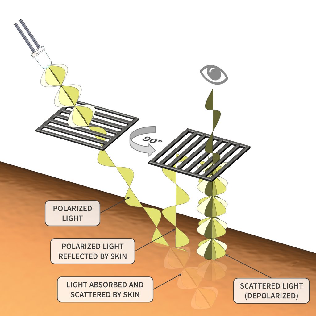 polarized light in dermoscopy