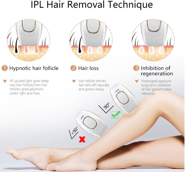 where to get laser hair removal