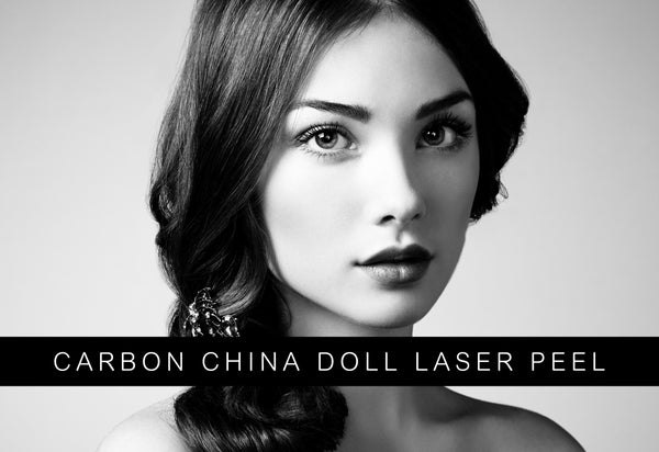 Carbon China Doll Laser Peel