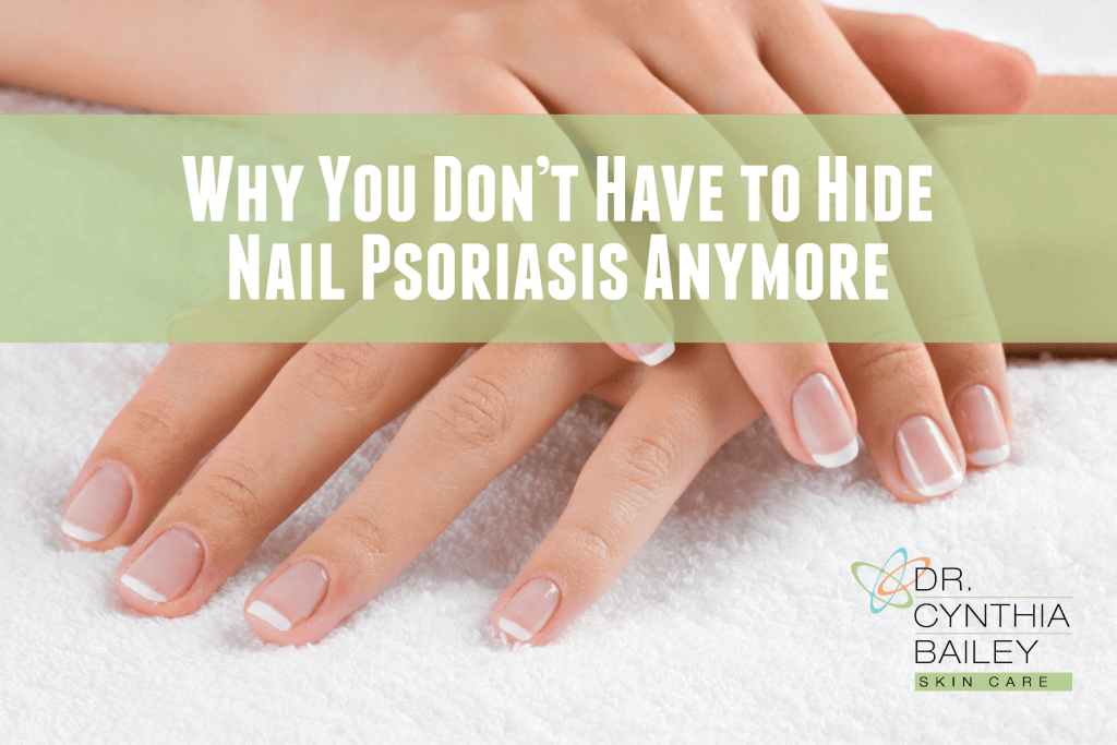 how to cover up nail psoriasis)