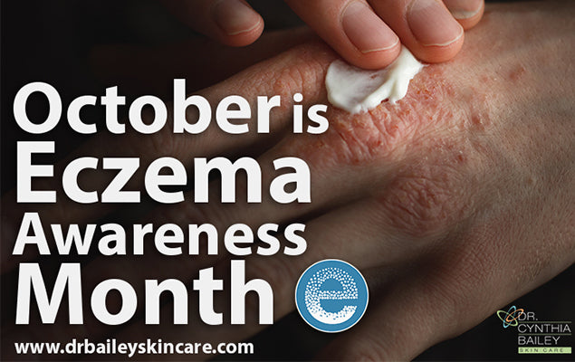 October Is Eczema Awareness Month Get The Details Here