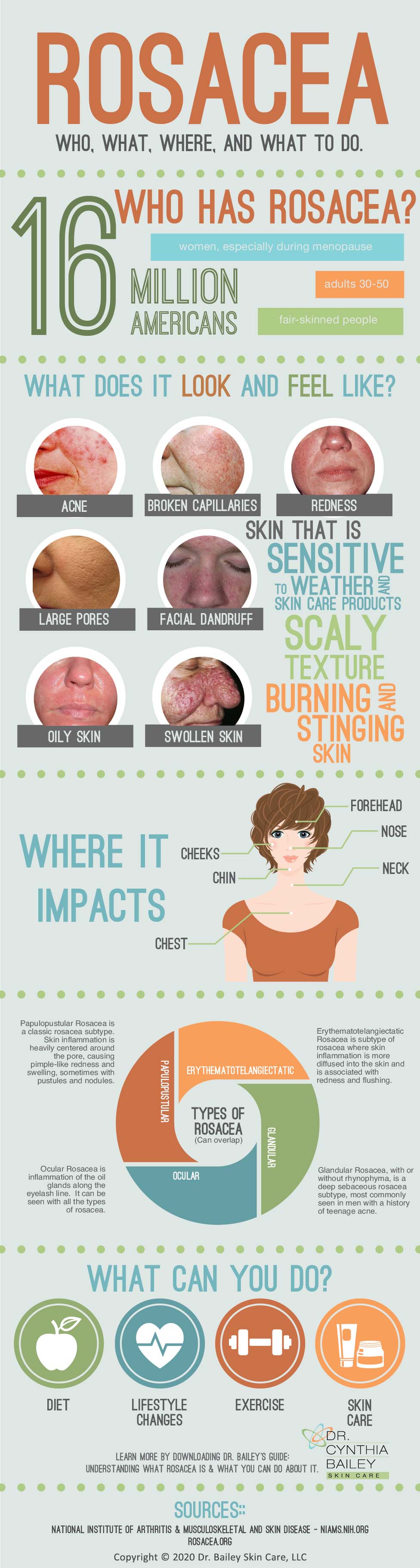 Rosacea Infographic