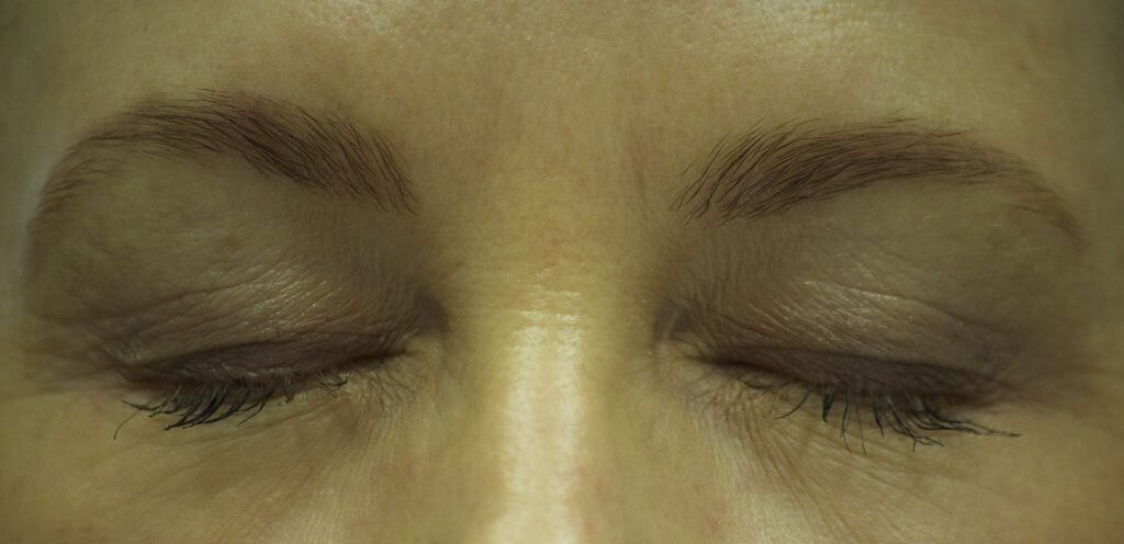 can you save your brows and eyelashes during chemotherapy