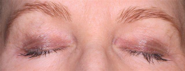 can you save your eyelashes and eyebrows on chemotherapy