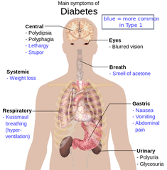 Symptoms of Diabetes