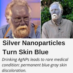 Drinking Silver Nanoparticles leads to rare medical condition: permanent blue-gray skin discoloration