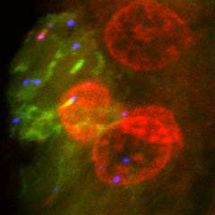 Nanoparticle Penetration and Accumulation in Liver Cancer