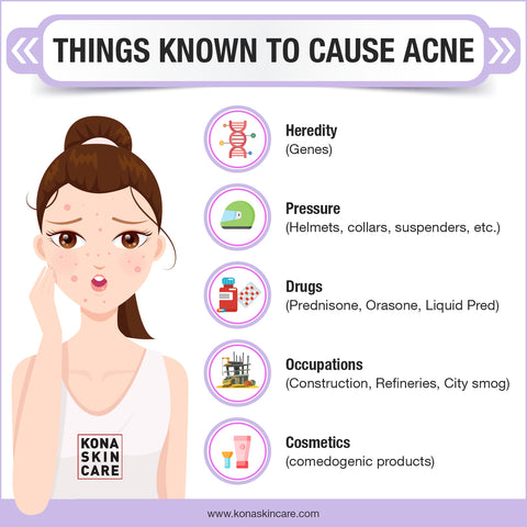 things known to cause acne infographic kona skin care