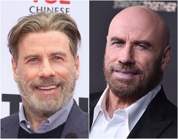 John Travolta with and without hair 