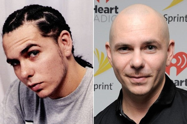 Pitbull with and without hair 