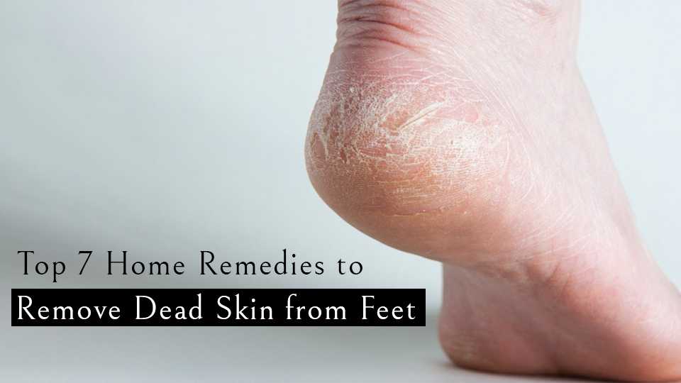 10 Ways To Remove Dead Skin From Your Feet