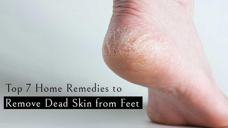 How to Get Dead Skin Off Your Feet: Tips, Prevention