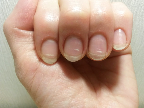white-marks-on-nails-emery-co-singapore-blog
