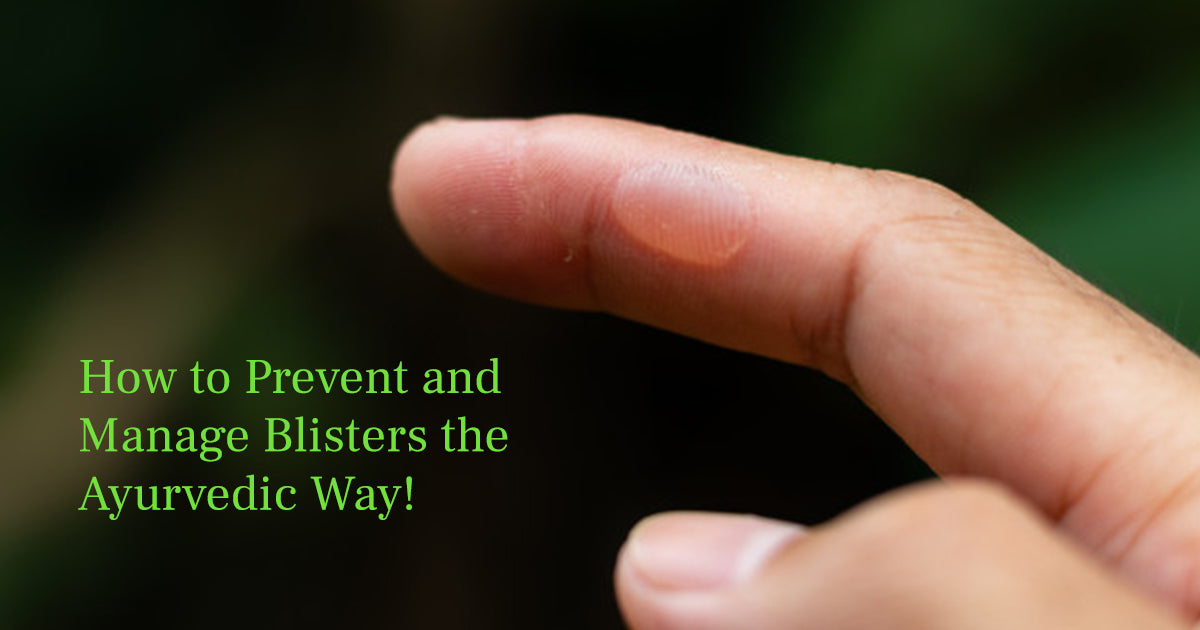 How to Prevent and Manage Blisters the Ayurvedic Way!
