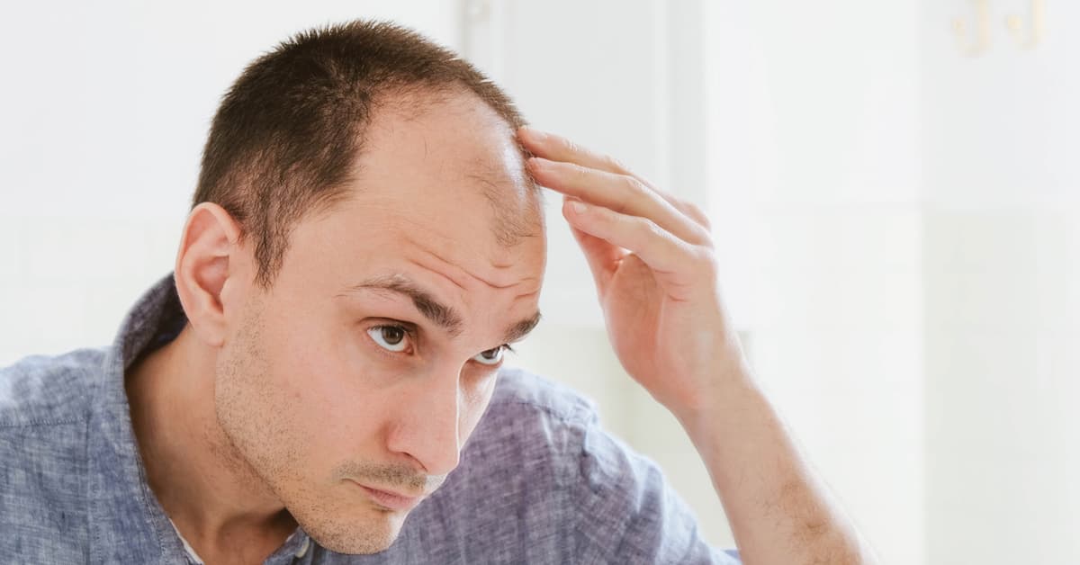 How DHT causes baldness and its 6 ways to treat – Derma Essentia