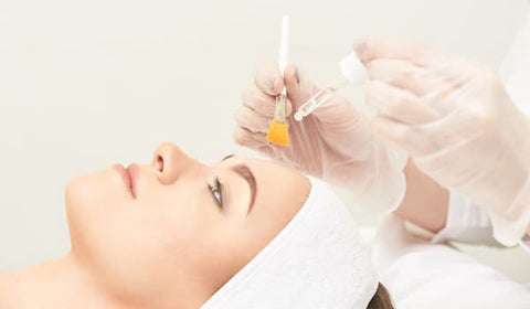 Chemical peel for acne scare