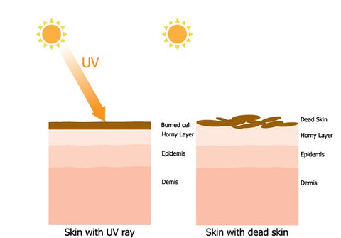 uv-rays-damage-to-skin-derma