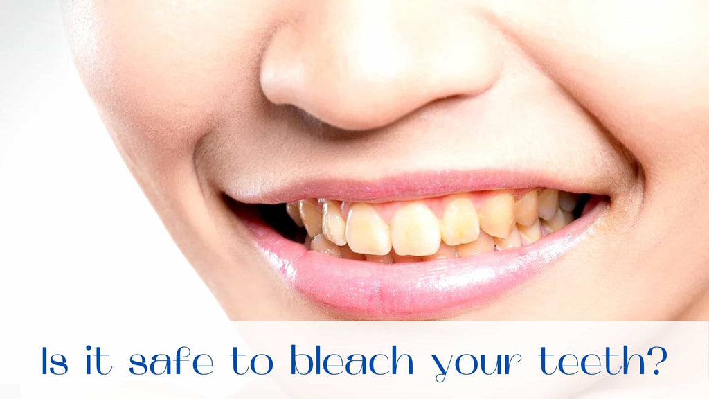 image-Tooth-whitening