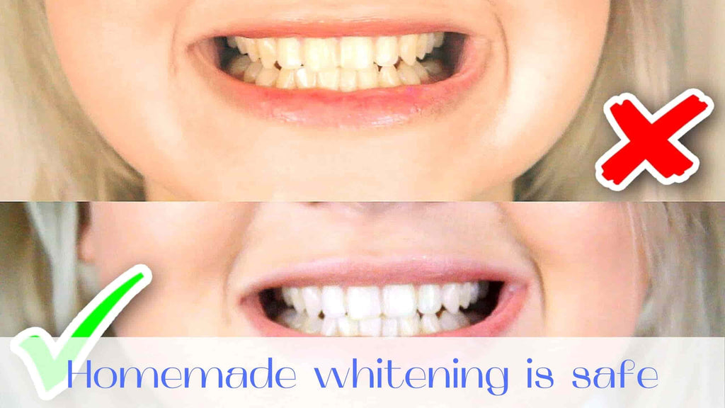 image-homemade-teeth-whitening