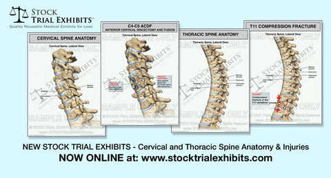 Stock Exhibits - Cervical Spine and Thoracic Spine Injuries