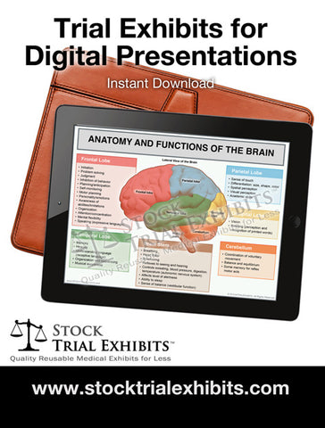 Medical Trial Exhibits for Digital Presentations in Personal Injury Cases from Stock Trial Exhibits