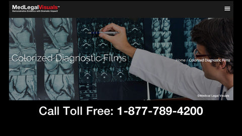 Colorized Diagnostic Films by Medical Legal Visuals