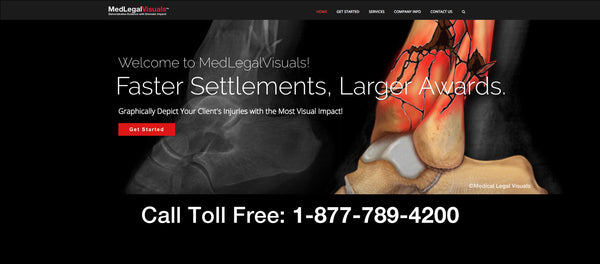 Medical Legal Visuals - Helps Trial Attorneys to Maximize Value of Injury Cases