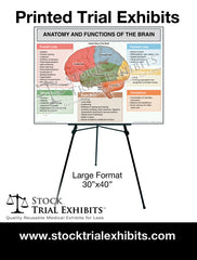 Trial Presentation Large Format Printed Trial Exhibit