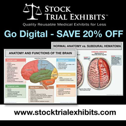 Lumbar Spine L1 Compression Fracture Trial Exhibit – Stock Trial
