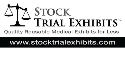 Cost Effective Medical Exhibits for Trial Attorneys from Stock Trial Exhibits