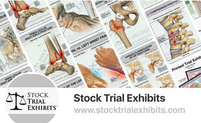 Trial Exhibits for Texas Injury Cases