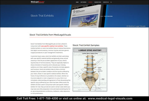 Stock Trial Exhibits from Medical Legal Visuals