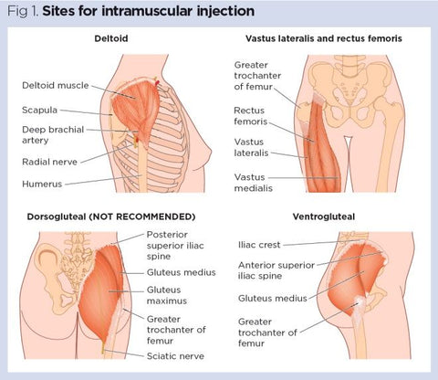 Intramuscular Recommended Injection Site