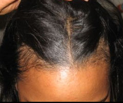 Thinning hair loss wigs and toppers