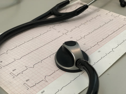 EKG, Elektrokardiograma, AFIB
