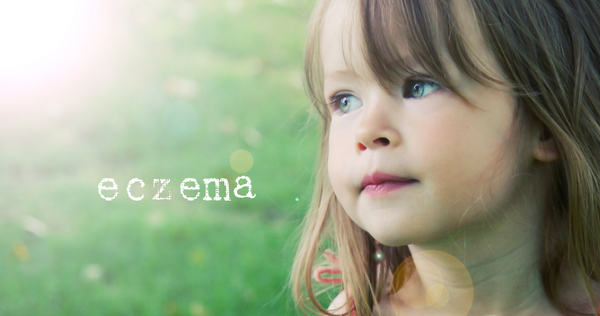 Eczema information and treatments