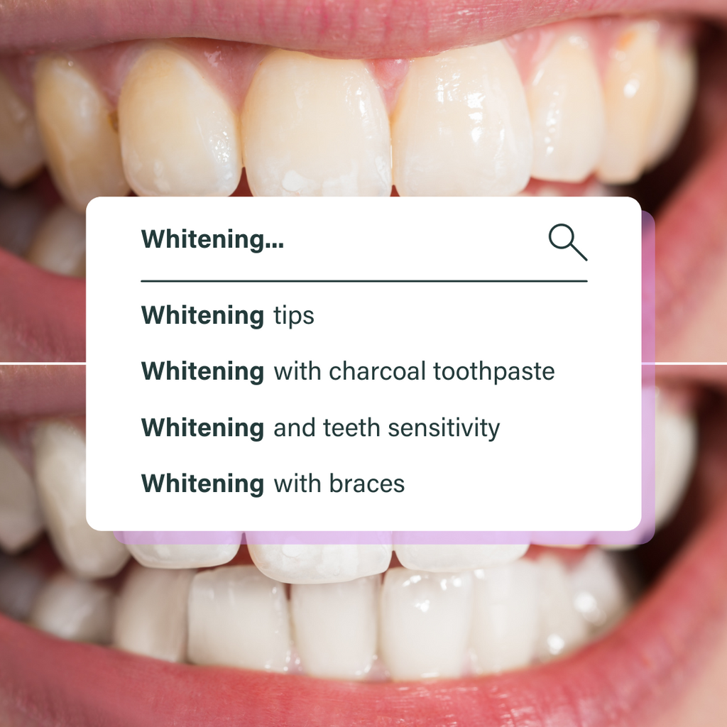 Teeth Whitening Tips & FAQs by a Cosmetic Dentist