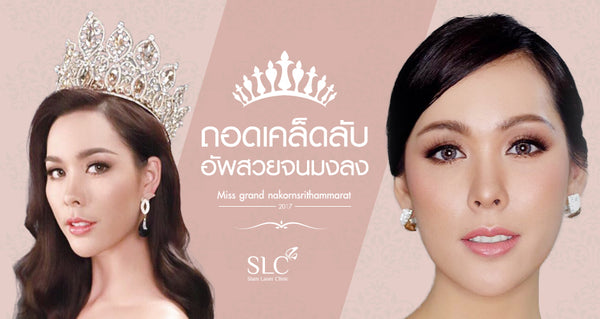 รีวิวสวยโดดเด่นแบบนางงาม ทำไมต้อง ยกคิ้ว ยกหน้าผาก Endoscopic Endotine for Brow Lift