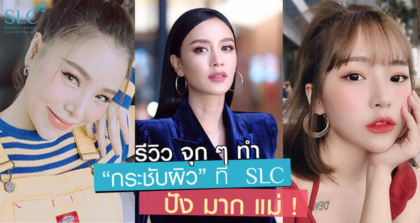 รีวิว Ulthera เลเซอร์หน้า ปังระดับยานแม่ของวงการ