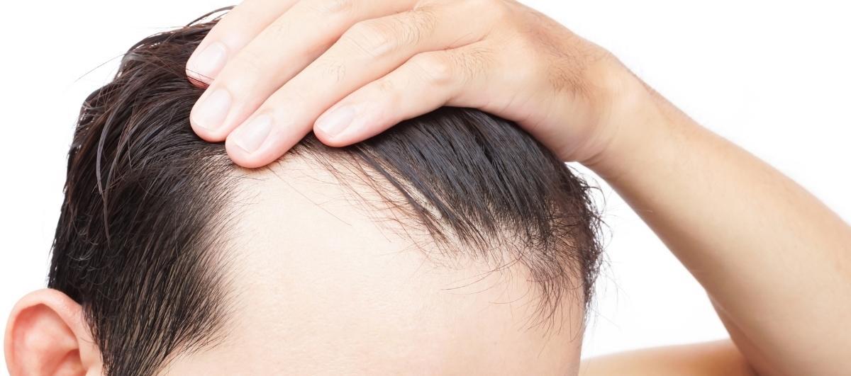 7 Simple Tips to Control Hair Fall – Re'equil