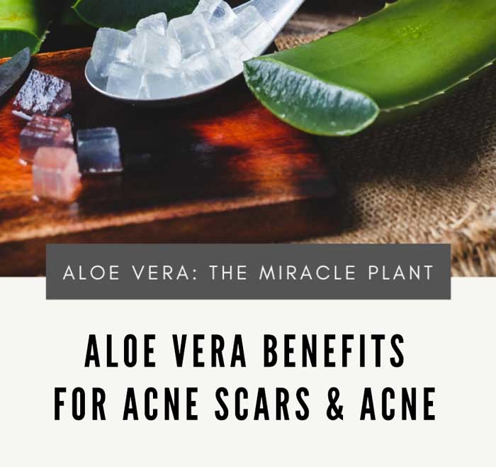 Aloe Vera For Acne Scars : The Benefits and Reviews