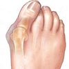 2PCS Silicone Gel Bunion Splint Big Toe Separator Straightener Foot Care Tool