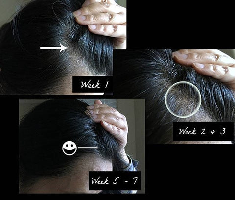 Before and After photos for RevivHair Placode Booster Serum
