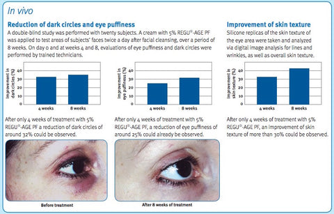 Before After photo of dark eye circles treated with REGU-AGE in TelomErase Serum