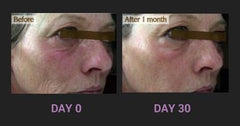 Dramatically lessened redness and wrinkles