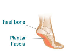 Plantar Fascia Heel Pain