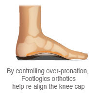 Orthotics for Knee Pain