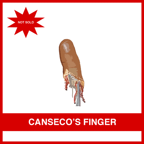 Jose Canseco's Finger