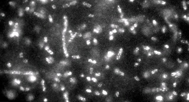 quantum dots detecting bacteria