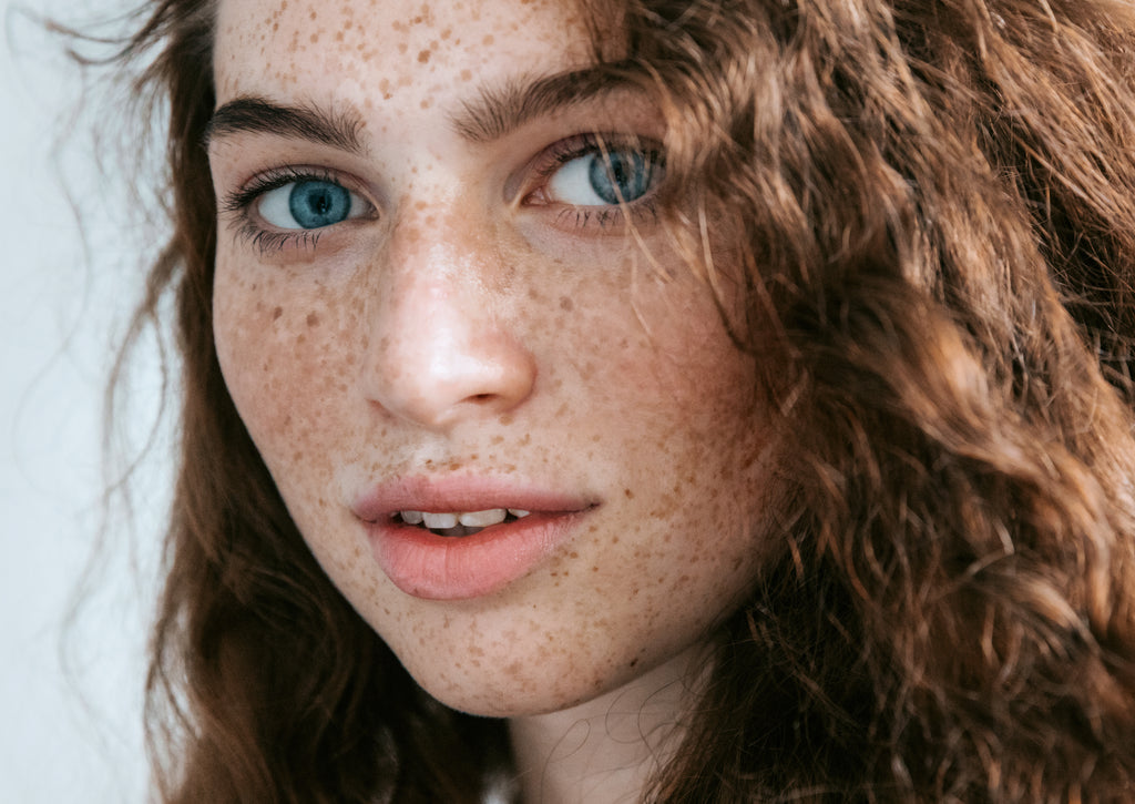 Blond Hair and Freckles: How to Embrace Your Features and Boost Your Confidence - wide 8